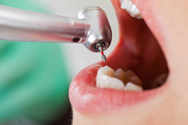 Best Urgent Dental Care for Toothache in Sheridan, CA